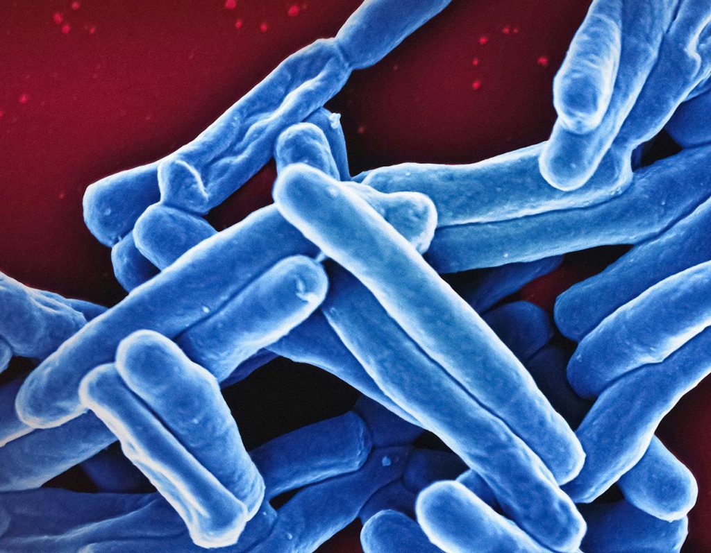 Mycobacterium Tuberculosis Bacteria Scanning electron micrograph
